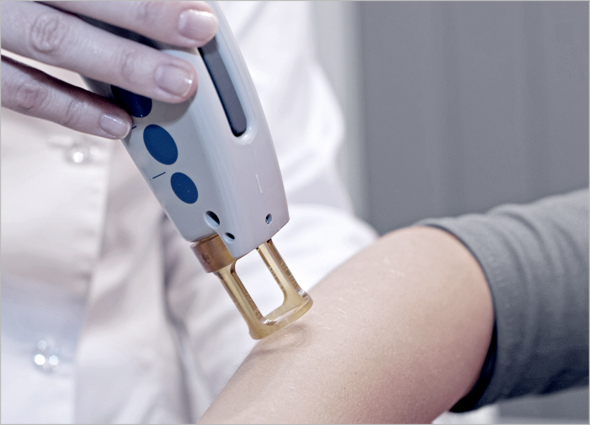 Skin Fungal Infection Laser