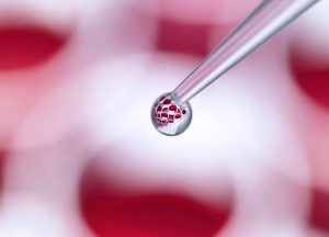 Stem Cell Hair Treatment