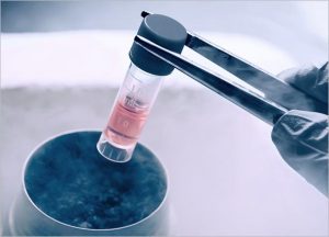 Stem Cell Hair Treatment