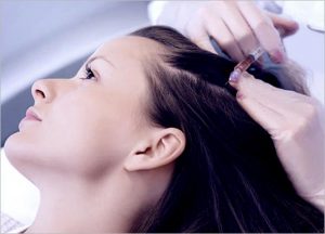 Stem Cell Hair Treatment