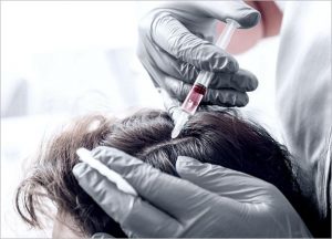 Stem Cell Hair Treatment