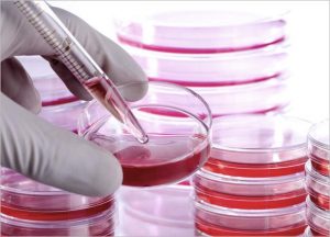 Stem Cell Hair Treatment