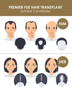 Suitable Candidates