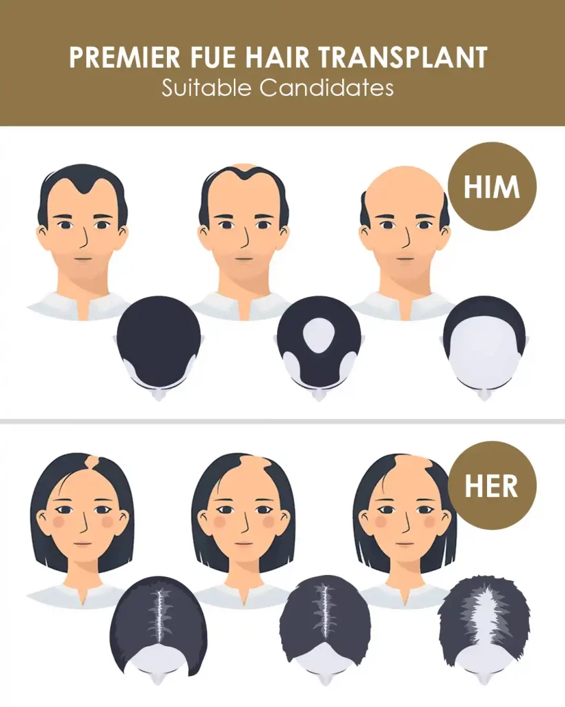 Suitable Candidates