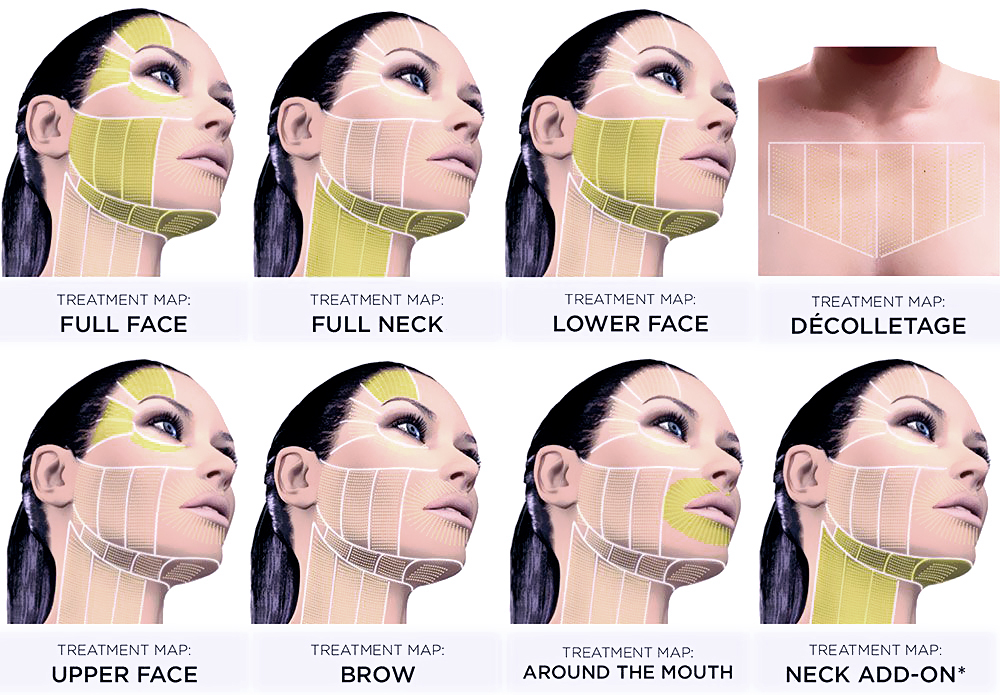 What is Ultherapy Focused Ultrasound Treatment