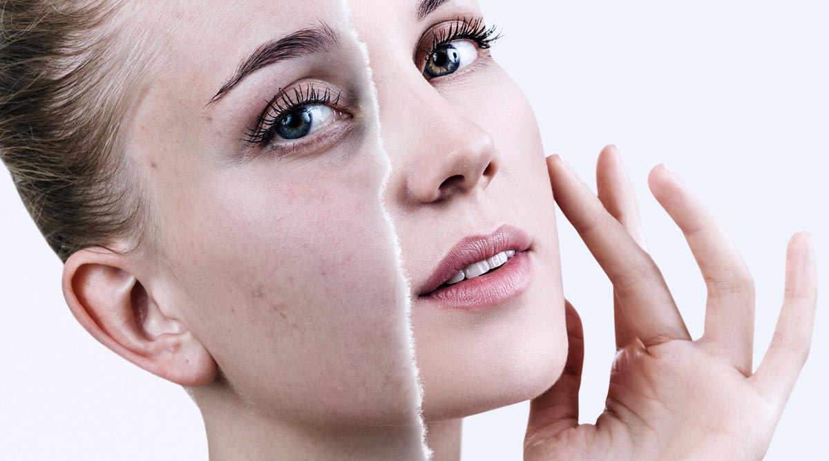 WHAT IS MESOTHERAPY