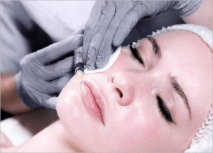 MESOTHERAPY