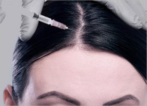 MESOTHERAPY