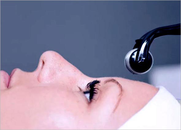 What is Derma Roller