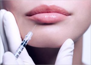 What is Ellanse Dermal Filler