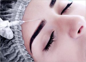 What is Ellanse Dermal Filler