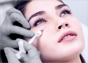 What is Ellanse Dermal Filler