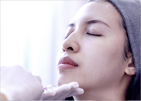 Ellanse Dermal Filler 