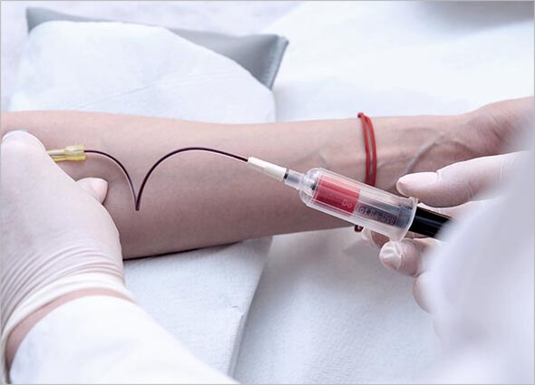 What is Platelet-rich Plasma