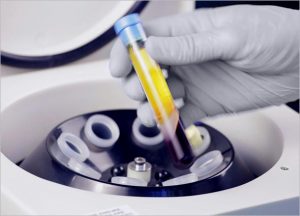 What is Platelet-rich Plasma