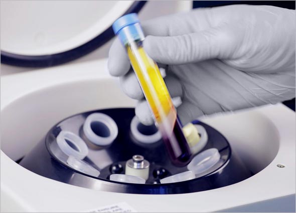 What is Platelet-rich Plasma