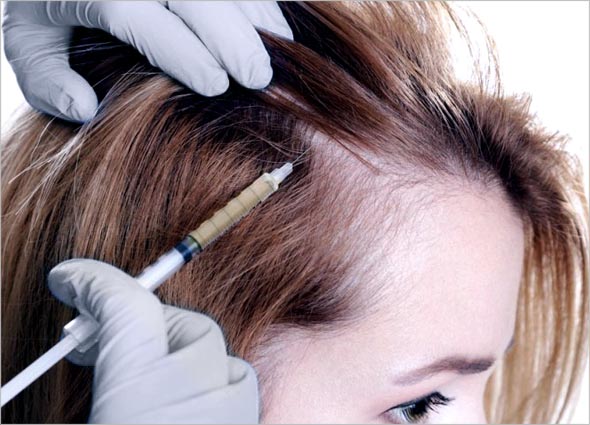 What is Platelet-rich Plasma