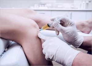 Platelet-rich Plasma