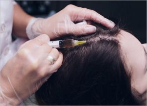 Platelet-rich Plasma
