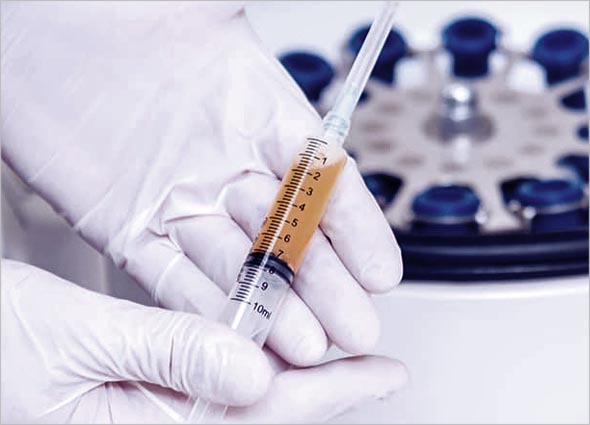 Platelet-rich Plasma