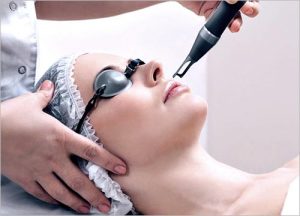 What is Q-switch Nd: YAG Laser