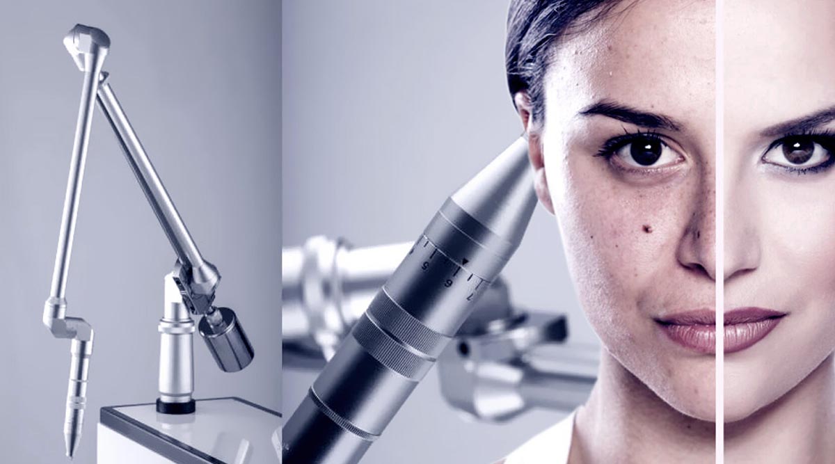 What is Q-switch Nd: YAG Laser