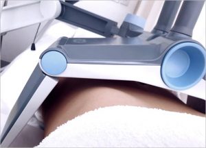 What is Vanquish Fat Reduction Treatment