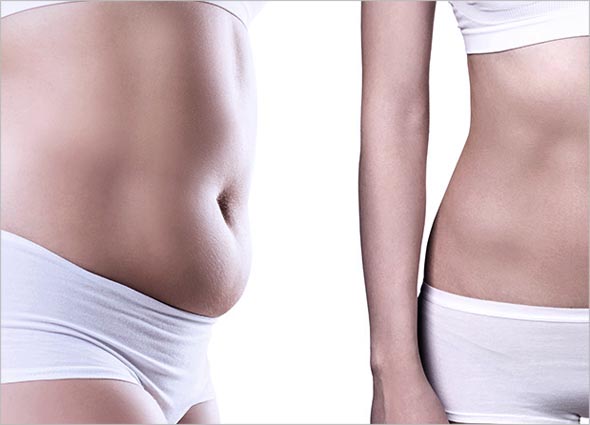 What is Vanquish Fat Reduction Treatment