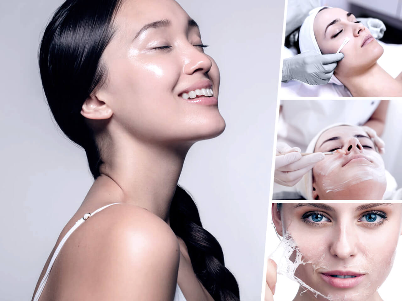Chemical Peel