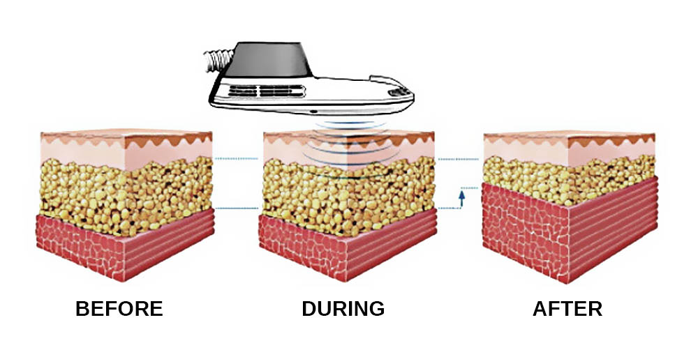 Functional Muscle System