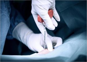 LipoCell Body Reshaping