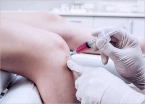 LipoCell Stem Cell