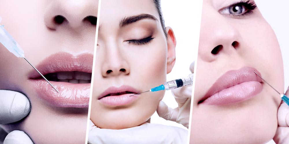 LIP FILLER : SECRET TO THE PERFECT POUT