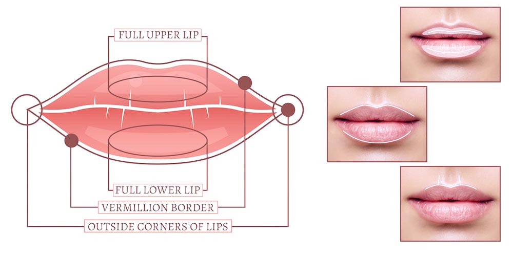 LIP FILLER : SECRET TO THE PERFECT POUT