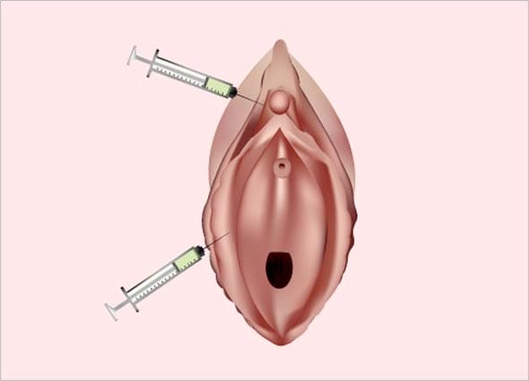 P-SHOT & O-SHOT FOR SEXUAL REJUVENATION
