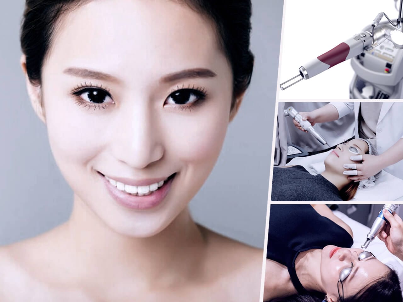 Pico Laser’s Acne Scar Treatment