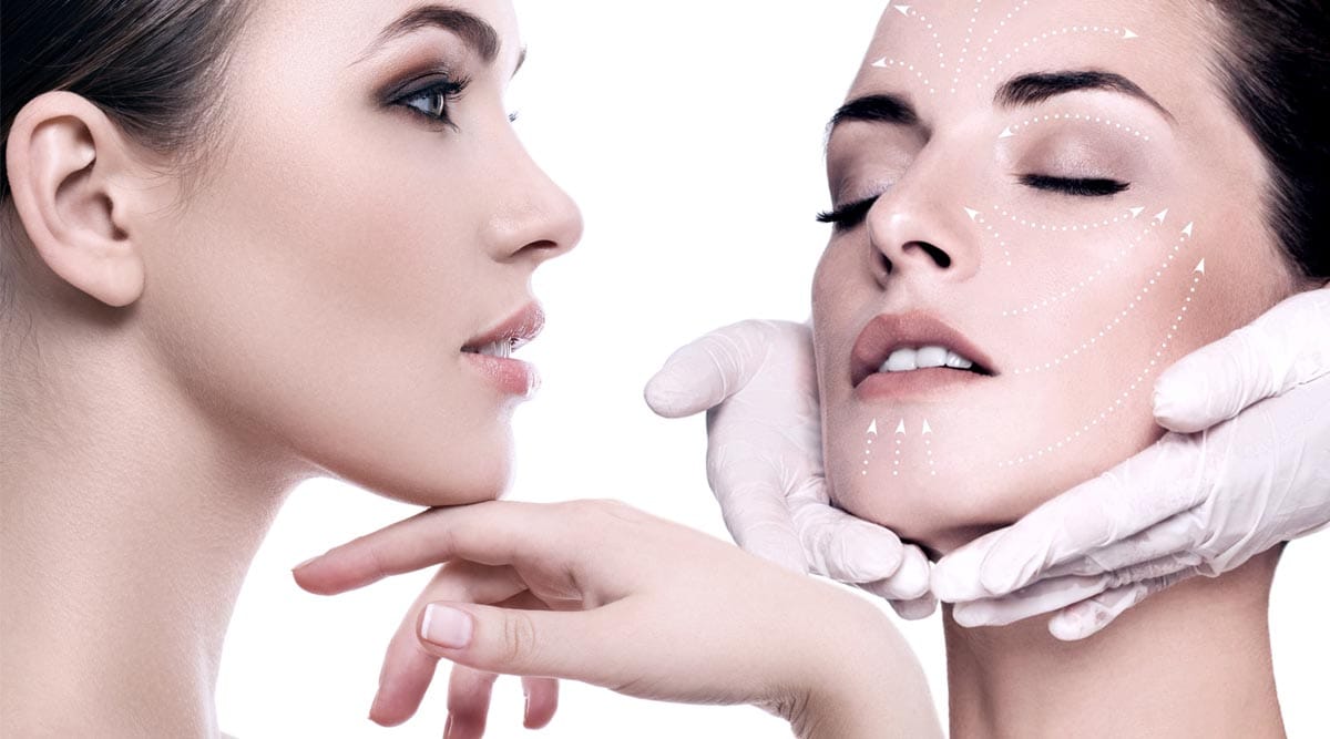 Silhouette Soft Thread Lift