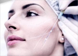 Thread Lift: Non-surgical Skin Lift