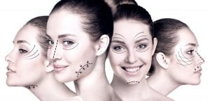 Thread Lift-Non-surgical Skin Lift