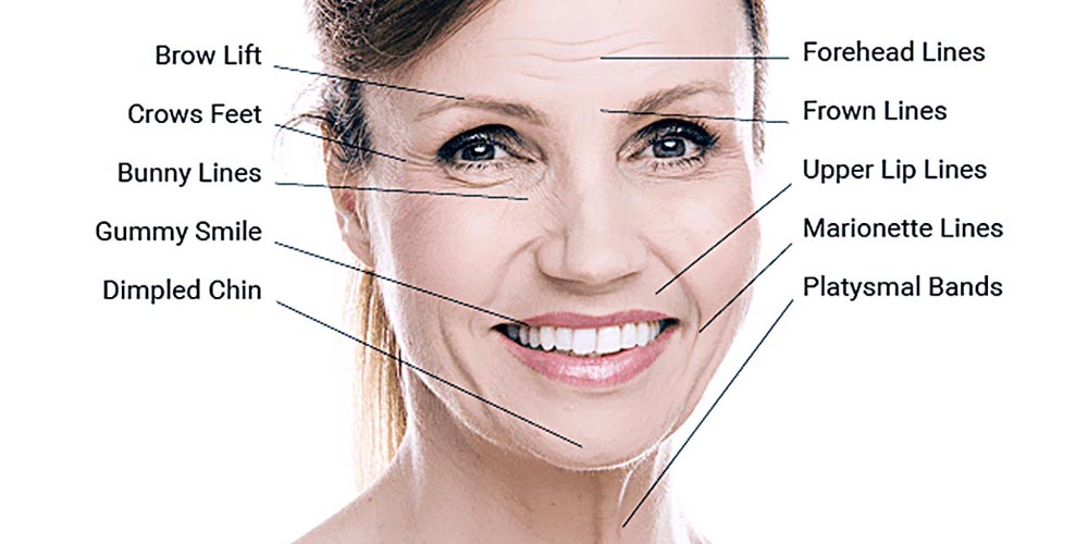 Botulinum Toxin 