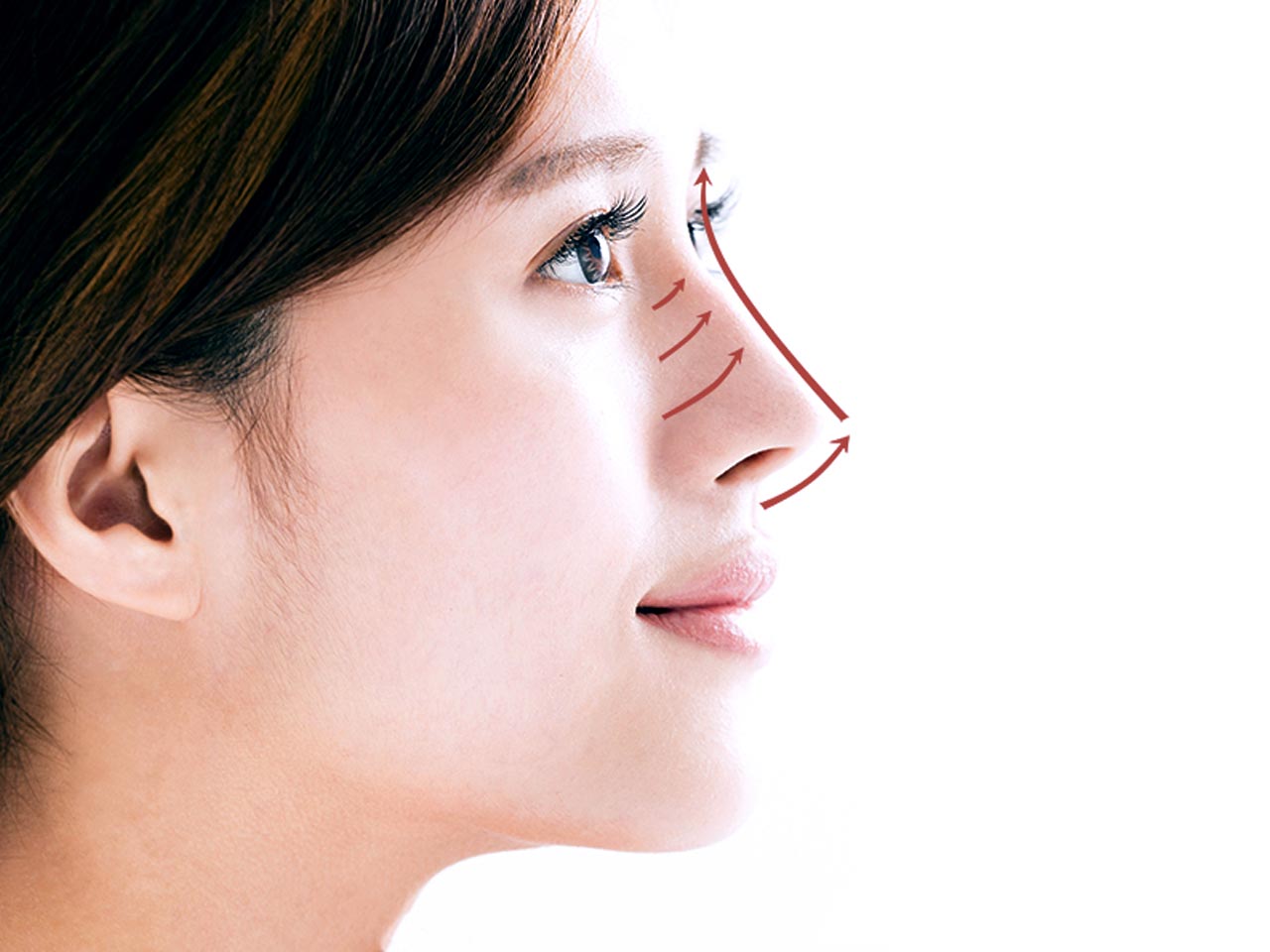 Non-Surgical Nose Job