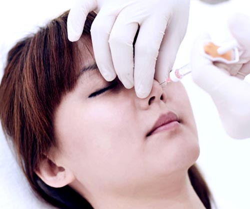 Nose Filler - Reversible