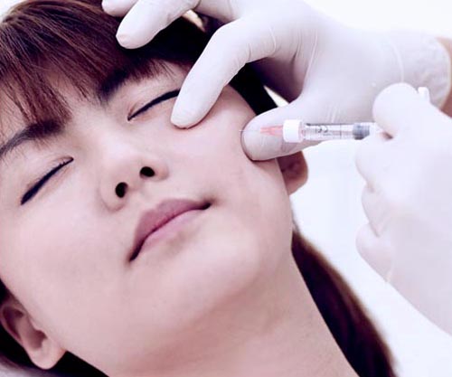 Profhilo Bio-Remodelling Anti Aging