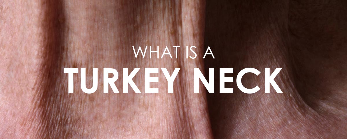 WHAT IS A TURKEY NECK