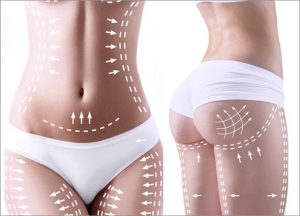 Shockwave Therapy