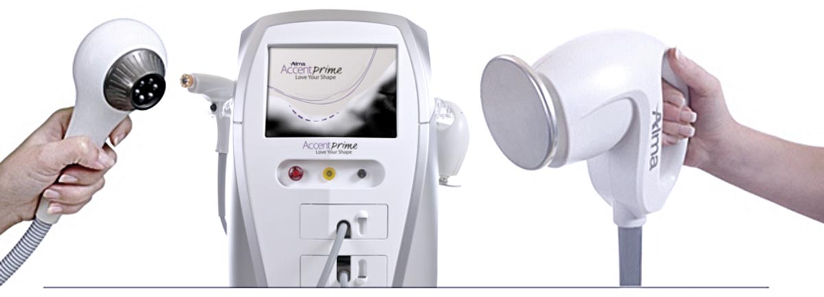 Alma Accent Prime