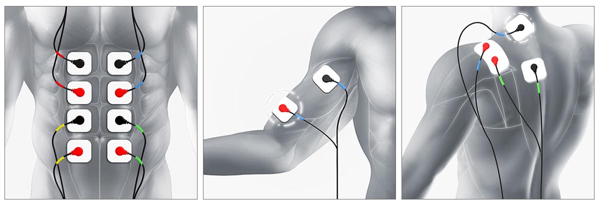 TRUSCULPT: THE ACE OF MUSCLE STIMULATOR THERAPY