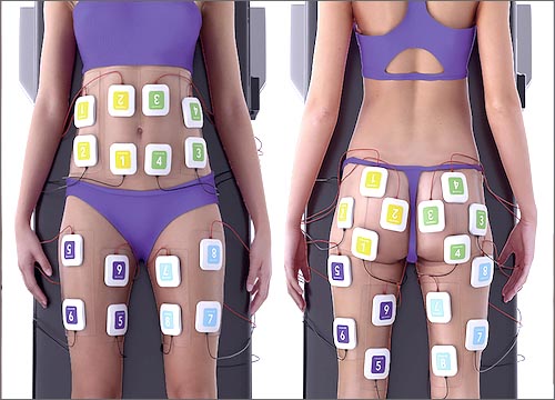 Trusculpt The Ace Of Muscle Stimulator Therapy