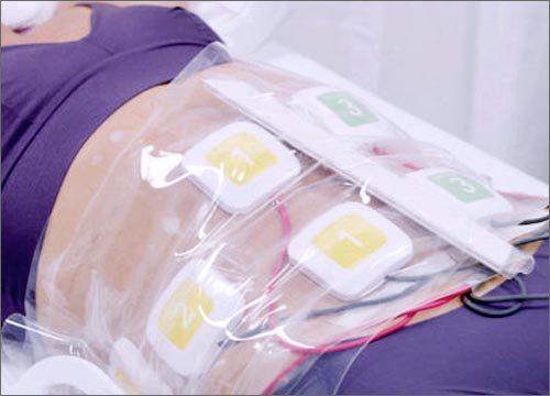 Trusculpt The Ace Of Muscle Stimulator Therapy 12