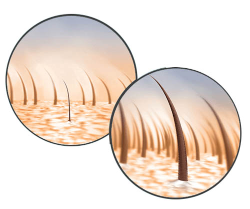 Premier Hair Loss Treatment